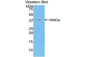 Detection of Recombinant ANXA5, Bovine using Polyclonal Antibody to Annexin V (ANXA5) (Annexin V 抗体  (AA 1-321))