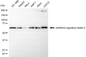 Western blotting analysis using interferon regulatory factor 6 antibody (ABIN7799087). (Recombinant IRF6 抗体)