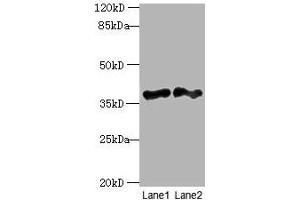 Western blot All lanes: DNAJB4 antibody at 2 μg/mL Lane 1: Hela whole cell lysate Lane 2: Mouse heart tissue Secondary Goat polyclonal to rabbit IgG at 1/10000 dilution Predicted band size: 38 kDa Observed band size: 38 kDa (DNAJB4 抗体  (AA 1-337))