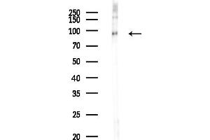 Western blot analysis of lysates from COLO205 cells(heat-shock,45 min treatment), using USP16 Antibody at 1/1000 dilution.