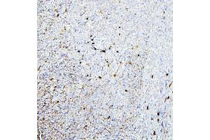 IHC analysis of ALDH1A1 using anti-ALDH1A1 antibody (ABIN7602127).
