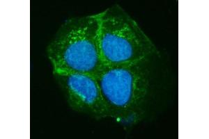 IF analysis of ATP7B using anti-ATP7B antibody (ABIN7600864).