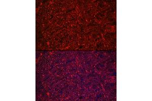 Immunofluorescence analysis of rat brain using Neurofilament L Rabbit mAb (ABIN7268867) at dilution of 1:100 (40x lens). (NEFL 抗体)
