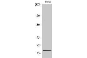 Western Blotting (WB) image for anti-Coiled-Coil Domain Containing 102B (CCDC102B) (Internal Region) antibody (ABIN3174218) (CCDC102B 抗体  (Internal Region))