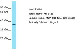 Host: Rabbit Target Name: MVB12B Sample Tissue: Human MDA-MB-435S Whole Cell Antibody Dilution: 1ug/ml (MVB12B 抗体  (C-Term))