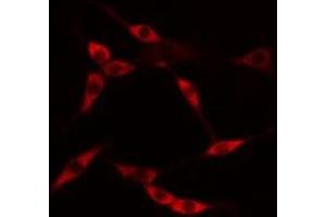 ABIN6275231 staining HuvEc cells by IF/ICC. (MAP9 抗体  (N-Term))