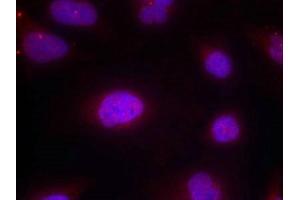 Immunofluorescence staining of methanol-fixed Hela cells using Cyclin B1(phospho-Ser147) Antibody. (Cyclin B1 抗体  (pSer147))