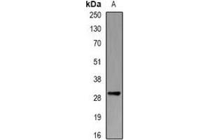 Western blot analysis of PSMB10 expression in THP1 (A) whole cell lysates. (PSMB10 抗体)