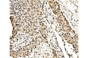 IHC analysis of SPHK1 using anti-SPHK1 antibody (ABIN7600168).