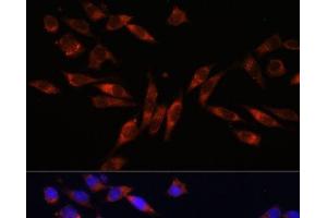 Immunofluorescence analysis of L929 cells using COL4A3 Polyclonal Antibody at dilution of 1:100. (COL4a3 抗体)