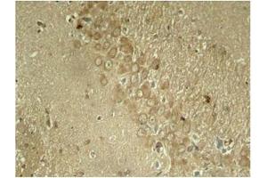 Image no. 1 for anti-Microtubule-Associated Protein tau (MAPT) (pSer262) antibody (ABIN196808) (MAPT 抗体  (pSer262))