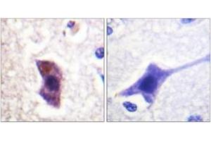 Immunohistochemistry analysis of paraffin-embedded human brain, using HRS (Phospho-Tyr334) Antibody. (HRS (HRS) (AA 301-350), (pTyr334) 抗体)