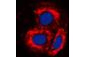 Immunofluorescent analysis of ALK1 staining in MCF7 cells.
