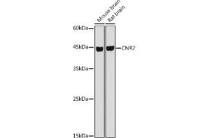 Western blot analysis of extracts of various cell lines, using CNR2 antibody (ABIN6133637, ABIN6138796, ABIN6138797 and ABIN6218862) at 1:1000 dilution. (CNR2 抗体  (AA 1-100))