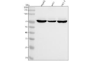 Western blot analysis of ZBTB7A using anti-ZBTB7A antibody (ABIN7606738).