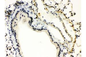 IHC testing of FFPE mouse lung with XBP1 antibody. (XBP1 抗体)