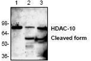 Image no. 1 for anti-Histone Deacetylase 10 (HDAC10) (N-Term) antibody (ABIN127250) (HDAC10 抗体  (N-Term))