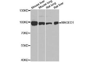 Western blot analysis of extracts of various cell lines, using MAGED1 antibody. (MAGED1 抗体)