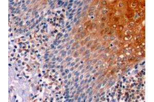 Detection of Bcl2 in Human Tonsil Tissue using Polyclonal Antibody to B-Cell Leukemia/Lymphoma 2 (Bcl2)