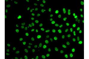 Immunofluorescence analysis of MCF-7 cells using SF3B2 antibody.