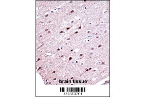 Immunohistochemistry (IHC) image for anti-Potassium Voltage-Gated Channel, Shal-Related Subfamily, Member 2 (KCND2) (AA 123-151), (N-Term) antibody (ABIN5533120)