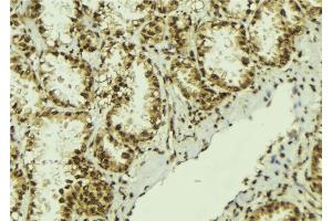 ABIN6273060 at 1/100 staining Human lung tissue by IHC-P. (NOB1 抗体  (C-Term))