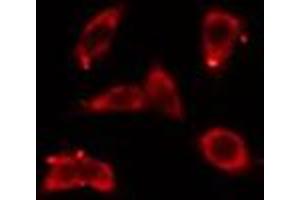 ABIN6276440 staining COLO205 cells by IF/ICC. (ARF6 抗体  (Internal Region))