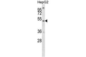 ALG11 Antibody (C-term) western blot analysis in HepG2 cell line lysates (35 µg/lane). (ALG11 抗体  (C-Term))