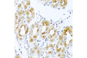 Immunohistochemistry of paraffin-embedded human stomach using TDGF1 antibody. (TDGF1 抗体)