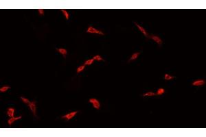 Immunofluorescence (fixed cells) (IF/ICC) image for anti-CREB Binding Protein (CREBBP) (C-Term) antibody (ABIN6260516)