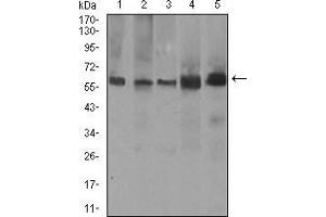 Western blot analysis using PDE1B mouse mAb against A549 (1), SK-MES-1 (2), PC-12 (3), NIH3T3 (4), and 3T3-L1 (5) cell lysate. (PDE1B 抗体  (AA 370-536))