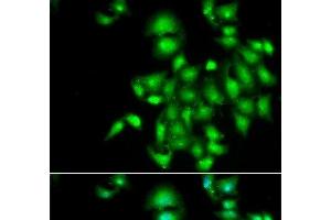 Immunofluorescence analysis of A549 cells using IL20 Polyclonal Antibody (IL-20 抗体)