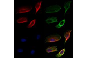 ABIN6259322 and ABIN6274776 staining Hela cells by IF/ICC. (RPL28 抗体  (C-Term))