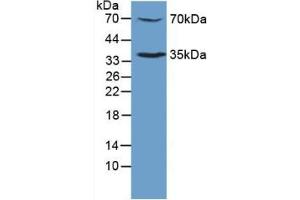 Detection of TPOR in Mouse Sp2/0 Cells using Polyclonal Antibody to Thrombopoietin Receptor (TPOR) (MPL 抗体  (AA 311-460))