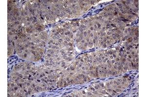 Image no. 1 for anti-Ribonucleotide Reductase M1 (RRM1) (AA 541-792) antibody (ABIN1491583) (RRM1 抗体  (AA 541-792))
