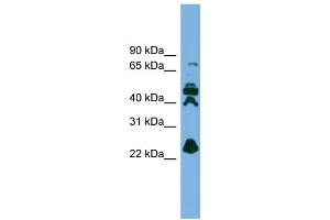 WB Suggested Anti-RPE Antibody Titration: 0. (RPE 抗体  (N-Term))