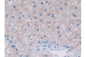 Detection of TFR2 in Human Liver Tissue using Polyclonal Antibody to Transferrin Receptor 2 (TFR2) (Transferrin Receptor 2 抗体  (AA 4-87))
