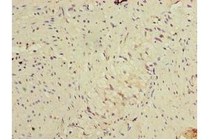 Immunohistochemistry of paraffin-embedded human colon tissue using ABIN7152486 at dilution of 1:100 (BTRC 抗体  (AA 701-1000))
