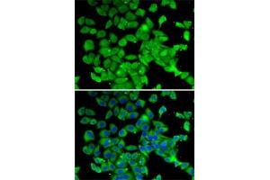 Immunofluorescence analysis of MCF7 cells using PARN antibody (ABIN6129553, ABIN6145230, ABIN6145231 and ABIN6222686). (PARN 抗体  (AA 1-280))