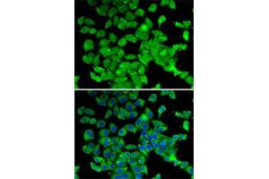 Immunofluorescence analysis of MCF7 cells using PARN antibody (ABIN6129553, ABIN6145230, ABIN6145231 and ABIN6222686). (PARN 抗体  (AA 1-280))