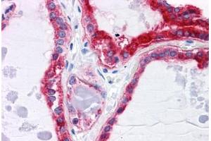 Human Thyroid: Formalin-Fixed, Paraffin-Embedded (FFPE) (CPVL 抗体  (AA 1-477))