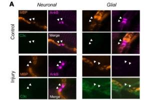 Immunostaining of ankyrin B (AnkB, magenta), MBP (orange), and C3c (green) in Neuronal and Glial injured mice in control and anti-GM1 treated groups. (ANK2 抗体  (AA 203-496))