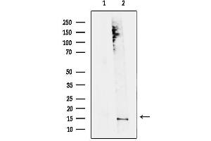 Western blot analysis of lysates from Jurkat cells, using MRFAP1 Antibody.