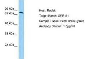 Image no. 1 for anti-G Protein-Coupled Receptor 111 (GPR111) (N-Term) antibody (ABIN6750187) (GP111 抗体  (N-Term))