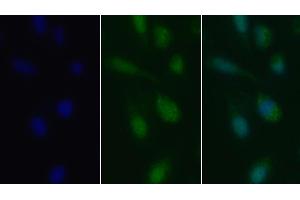 Detection of TGFb1 in Human U2OS cell using Polyclonal Antibody to Transforming Growth Factor Beta 1 (TGFb1) (TGFB1 抗体  (AA 279-390))
