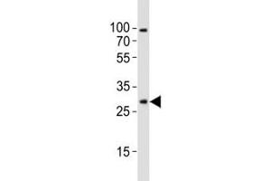 Western blot analysis of lysate from mouse brain tissue lysate using Olig1 antibody diluted at 1:1000. (OLIG1 抗体  (AA 161-184))