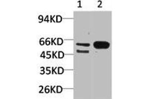 Western blot analysis of 1) Mouse Brain Tissue, 2)Rat Brain Tissue with GABA A Receptor α3 Rabbit pAb diluted at 1:2,000. (GABRA3 抗体)