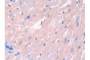 Immunohistochemistry (IHC) image for anti-Lecithin-Cholesterol Acyltransferase (LCAT) (AA 41-210) antibody (ABIN7436696)