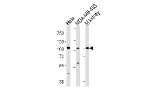 Western blot analysis in Hela,MDA-MB-453 cell line and mouse kidney tissue lysates (35ug/lane). (NCOA7 抗体  (N-Term))