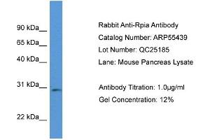 Western Blotting (WB) image for anti-Ribose 5-Phosphate Isomerase A (RPIA) (Middle Region) antibody (ABIN2786211) (Ribose 5-Phosphate Isomerase A (RPIA) (Middle Region) 抗体)